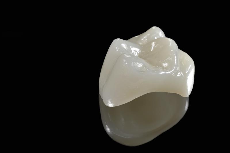 Porcelain Crowns  Gresham, OR, 